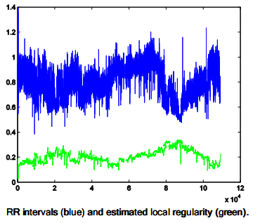 figure1ecg